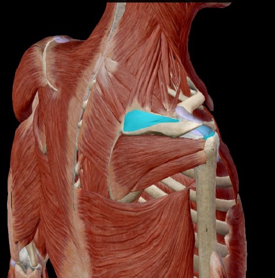 Síndrome subacromial, tendinitis o tendinosis en el hombro.